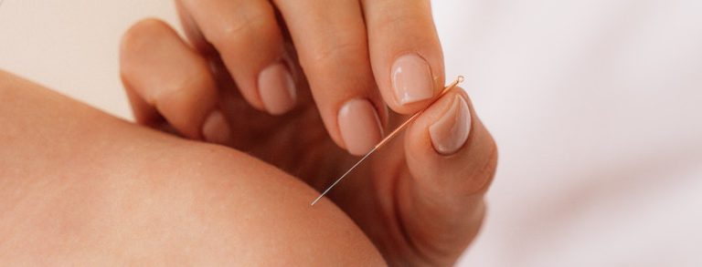 find-out-whether-or-not-medicare-covers-acupuncture